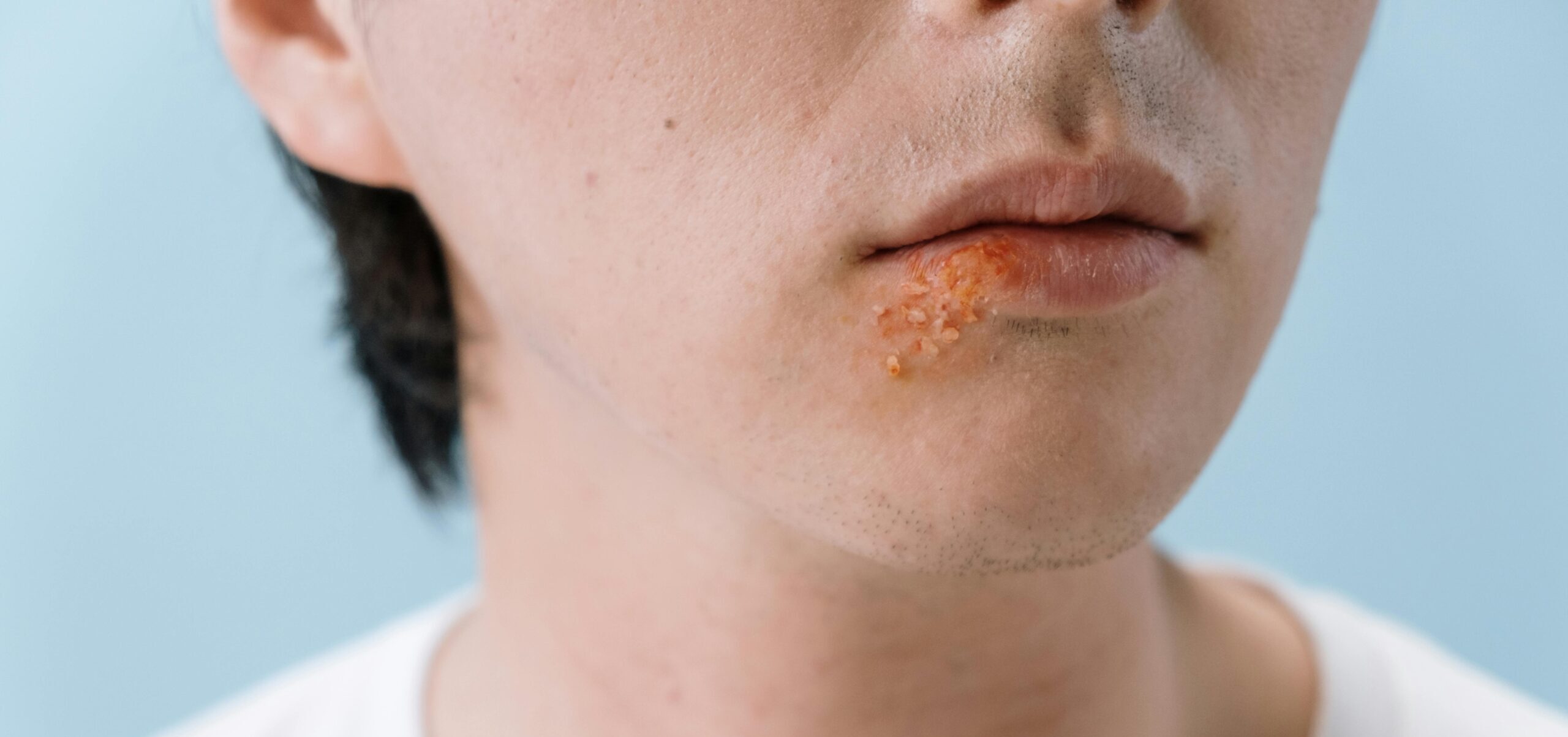 pexels cottonbro 5712684 scaled e1739727030180