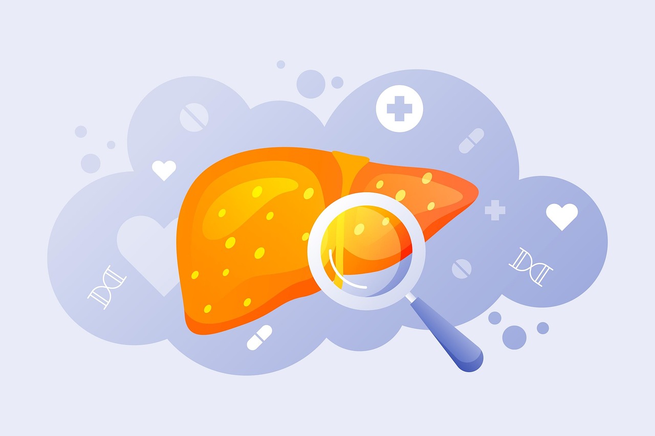 Viscelarna mast, ubica broj 1: Krije se i kod mršavih osoba 1 Viscelarna mast: Ilustracija masne jetre