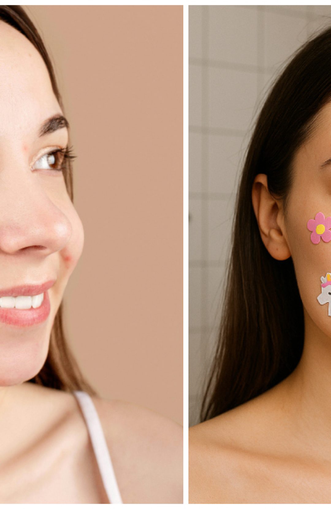 Pimple patches ili flasteri za bubuljice: devojke sa bubuljicama i flasterima